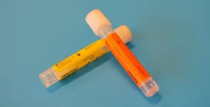 Urinproben in Gläsern werden gezeigt.