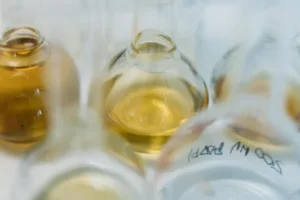 Eine Urinprobe in einem Laborumfeld wird gezeigt.